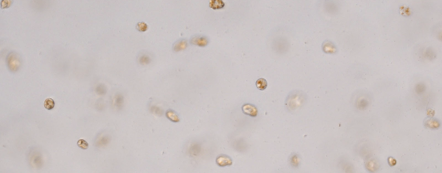 Heterosigma akashiwo cells under a microscope